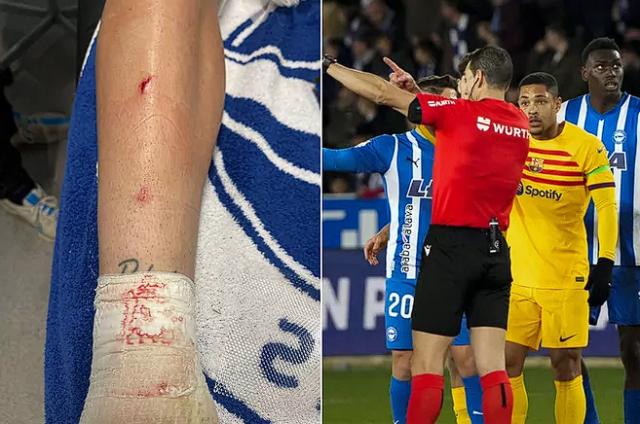 开云体育下载-小老虎被罚下，巴萨佐证自己喷皇马有理？